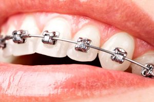 especialidad-ortodoncia